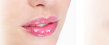 Chirurgie Lèvre marseille