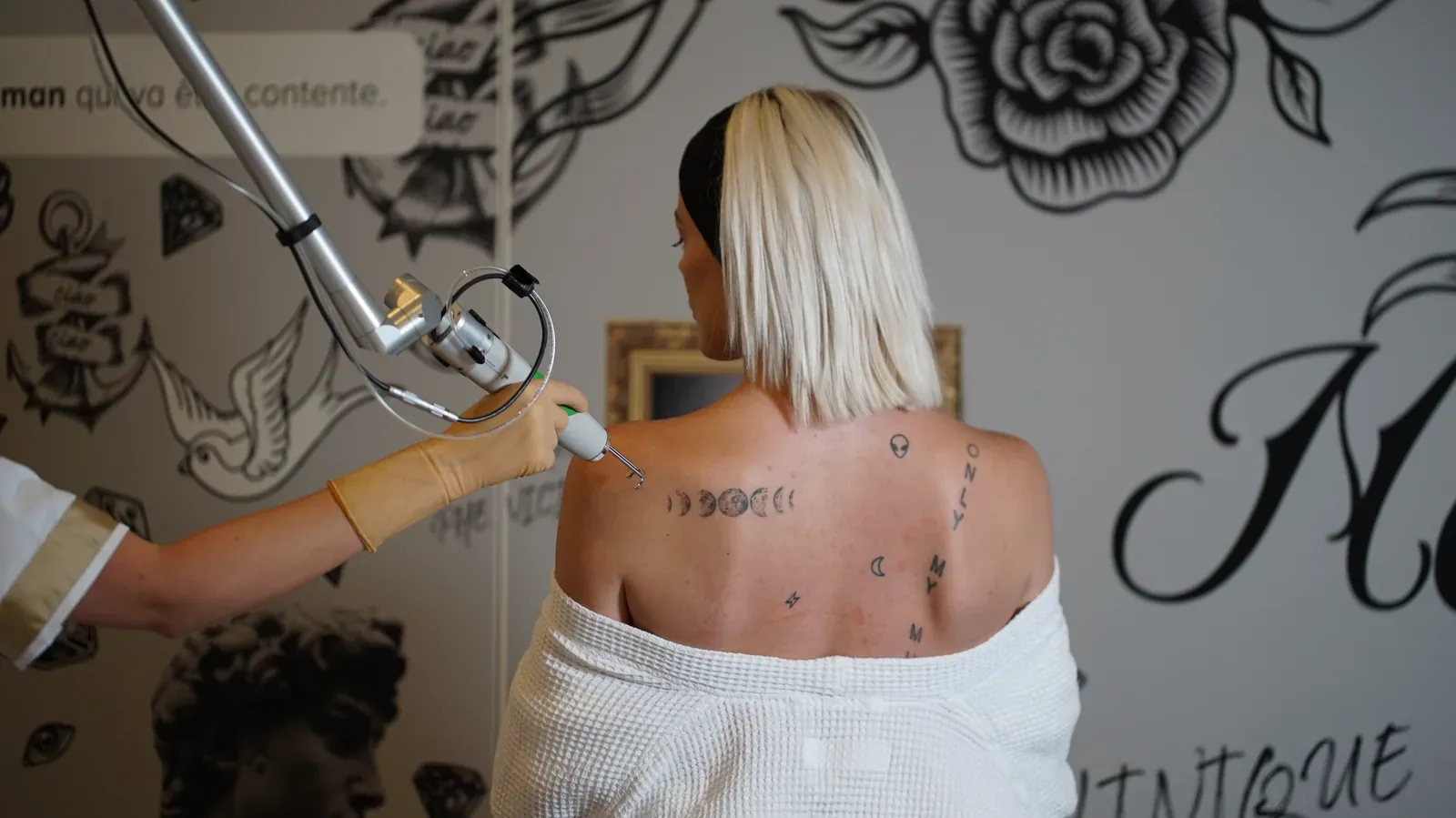 Détatouage laser picoseconde à la Clinique Phenicia Marseille