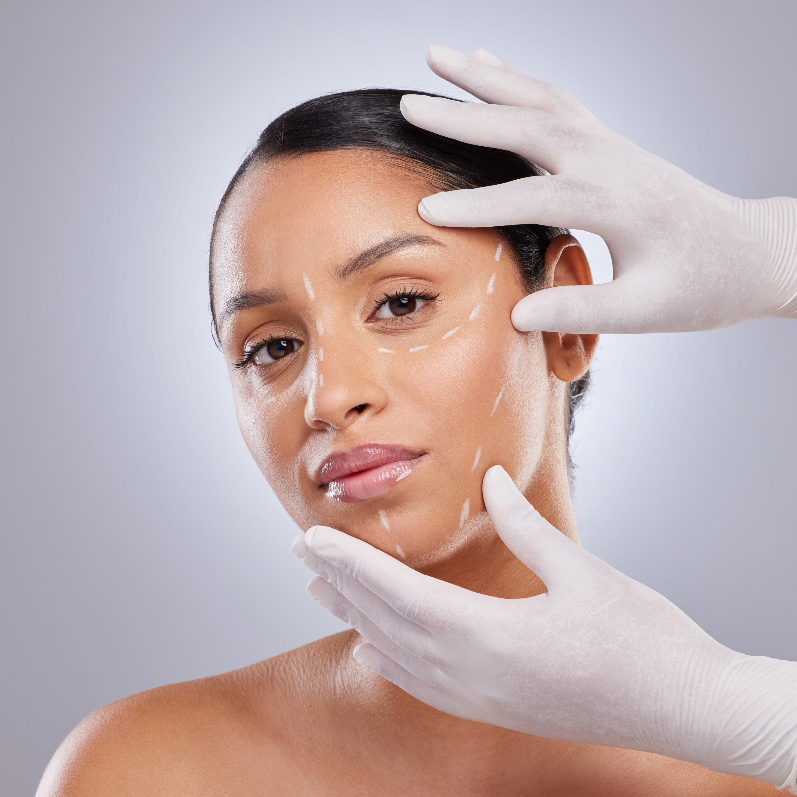 Consultation médicale et examen de la peau avant une séance de Skinbooster à la Clinique Phenicia Marseille
