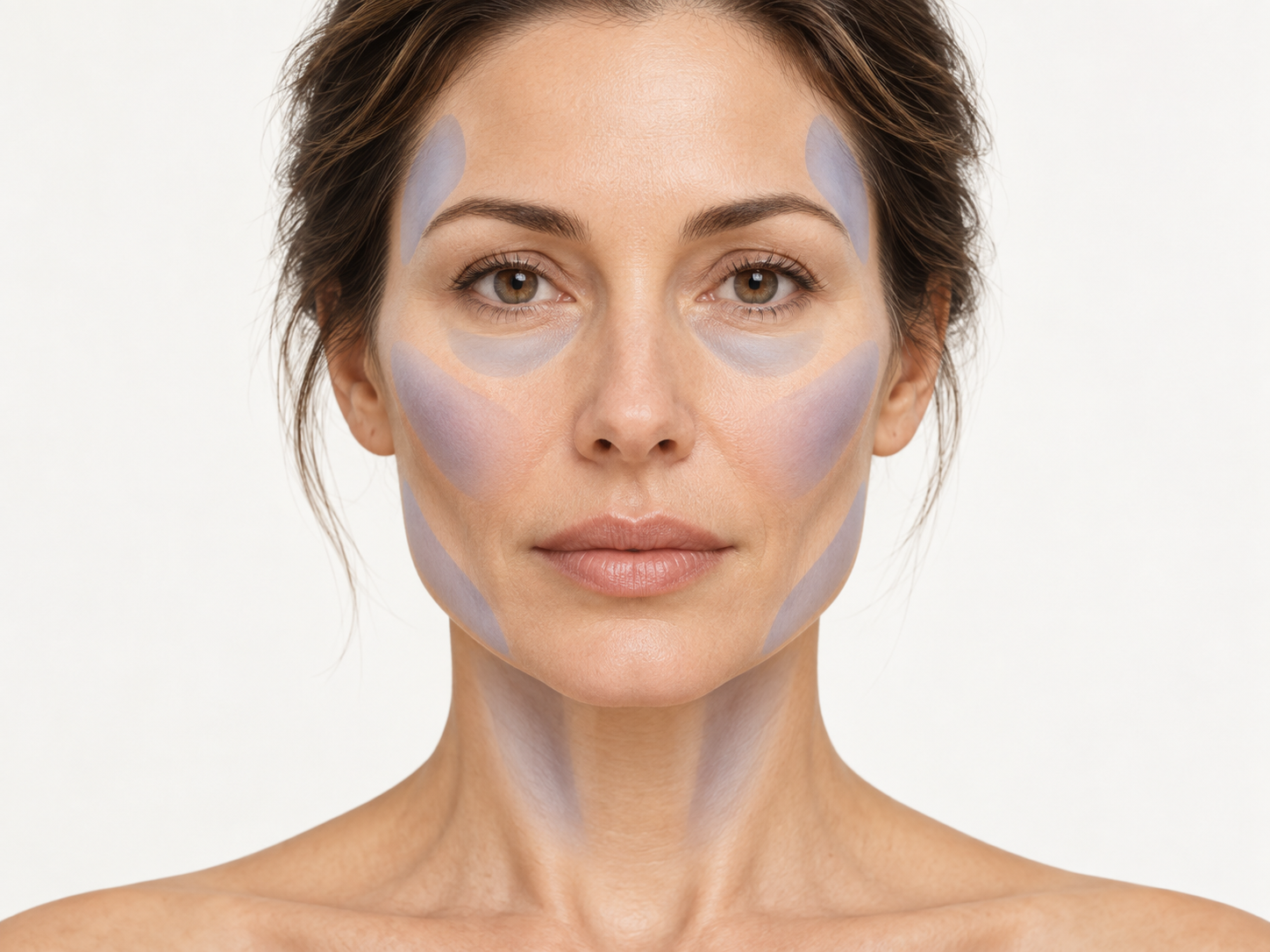 Restauration des volumes du visage par greffe de graisse autologue, Clinique Phenicia Marseille